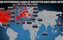 Bệnh viêm gan bí ẩn tiếp tục diễn biến phức tạp trên toàn thế giới