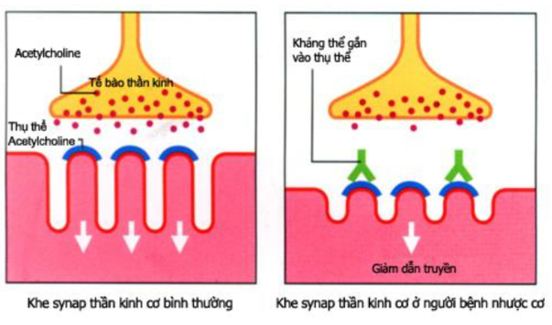 MSC-CM và tiềm năng điều trị bệnh nhược cơ